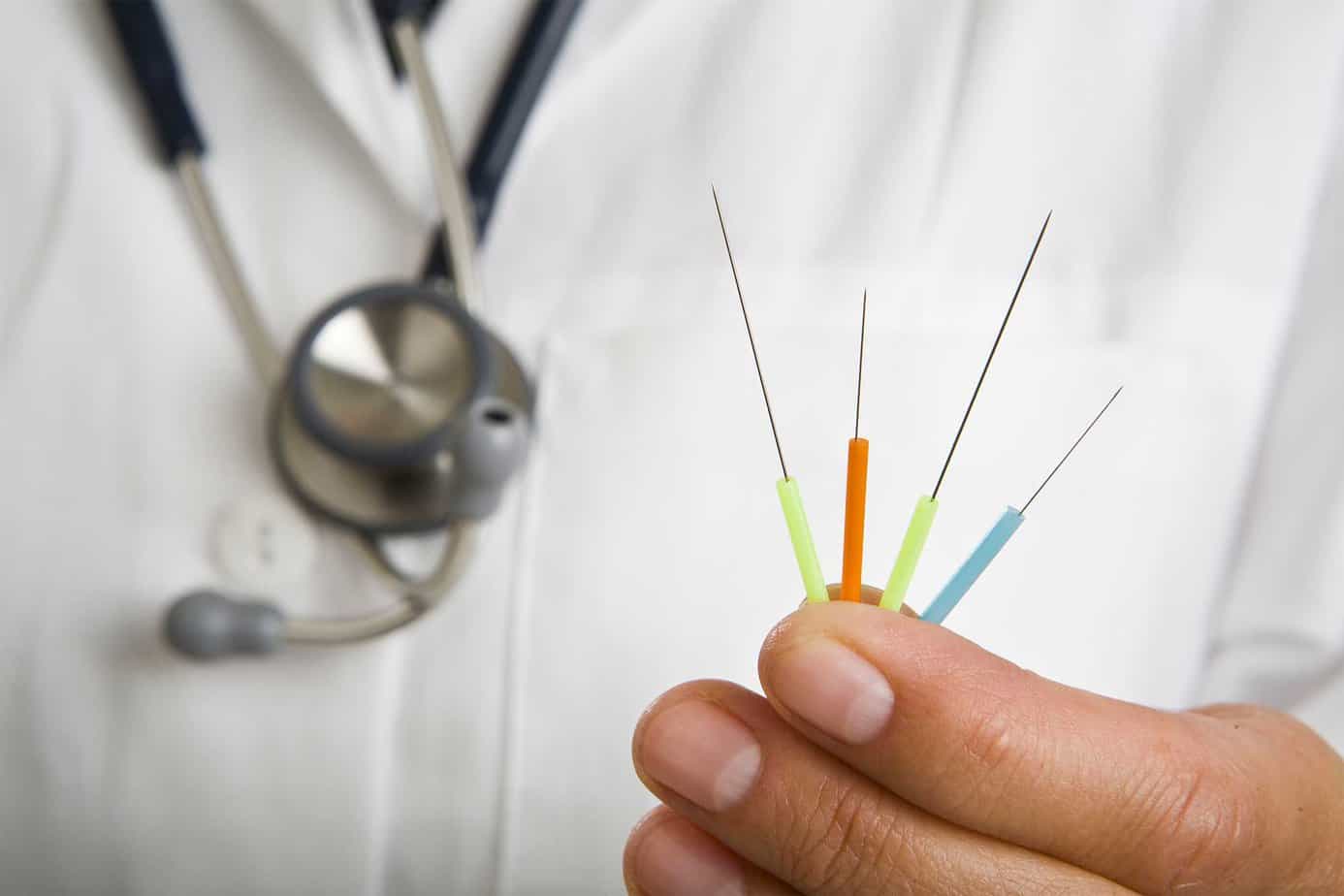Study Says: Acupuncture Is a Safe Alternative for Painkillers