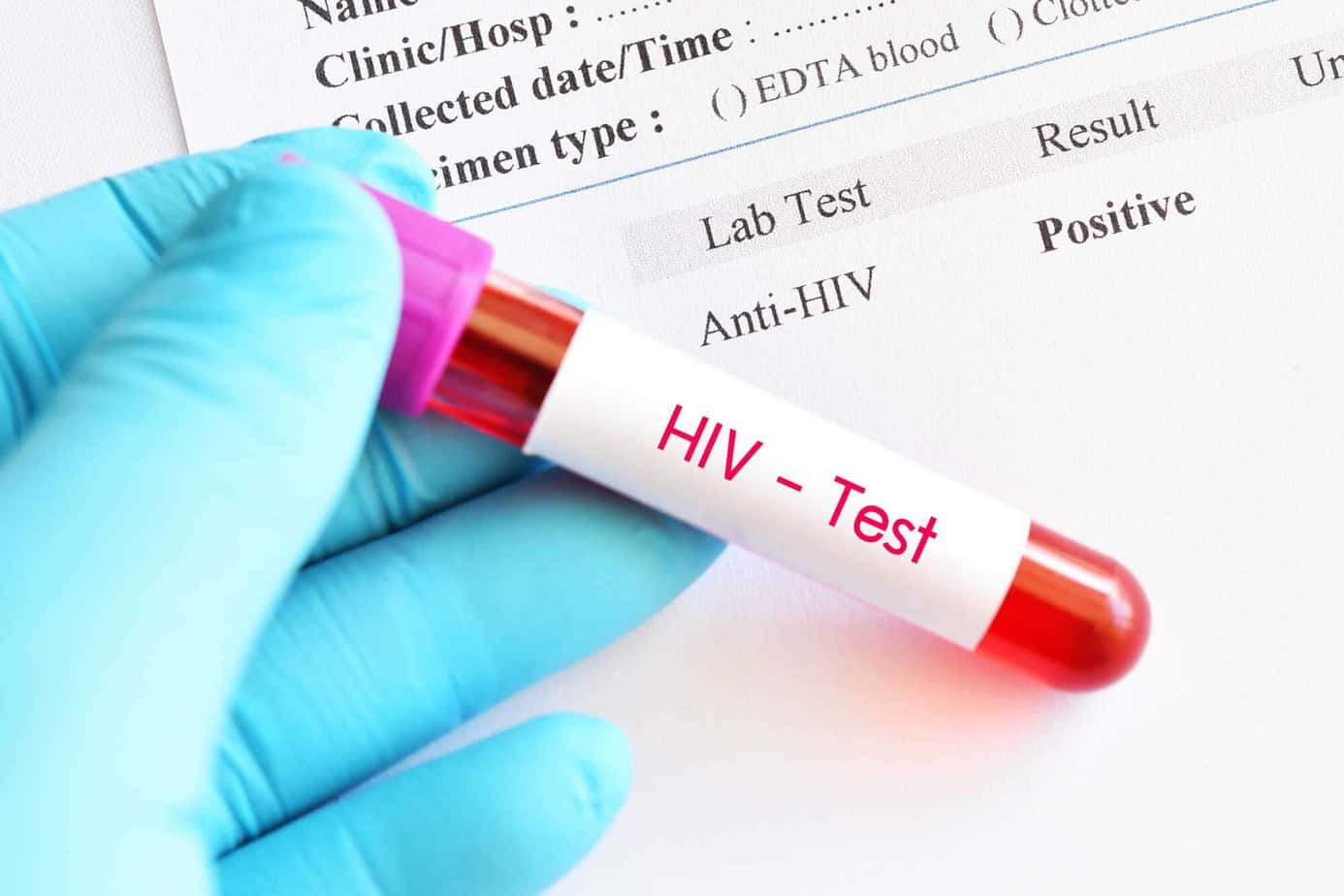 hand holding hiv test vial full of blood